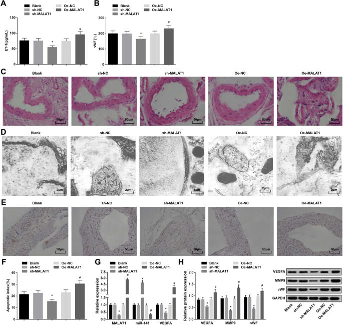 MALAT1/miR-143/VEGFA Axis Drives Endothelial Damage Leading to Intracranial Aneurysm