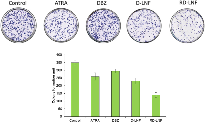 Enhanced Antitumor Effect of Dacarbazine and All-Trans Retinoic Acid Co-Delivered via Lipid Nanoparticles for Malignant Melanoma
