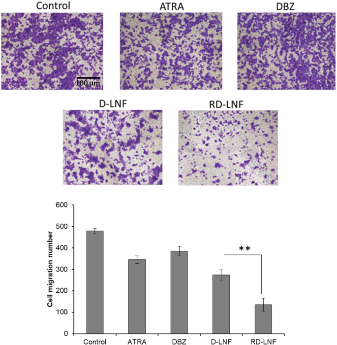 Enhanced Antitumor Effect of Dacarbazine and All-Trans Retinoic Acid Co-Delivered via Lipid Nanoparticles for Malignant Melanoma