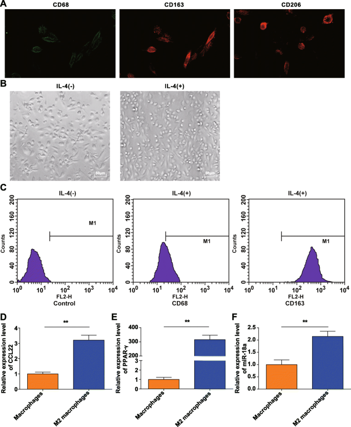 MicroRNA‑18a from M2 Macrophages Drives Nasopharyngeal Carcinoma Progression by Targeting TGFBR3 in the TGF‑β Pathway