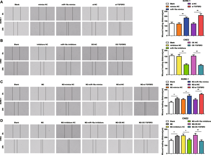 MicroRNA‑18a from M2 Macrophages Drives Nasopharyngeal Carcinoma Progression by Targeting TGFBR3 in the TGF‑β Pathway