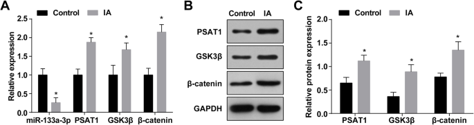 Restoring miR‑133a‑3p or Reducing PSAT1 Limits Endothelial Damage‑Driven Intracranial Aneurysm by Inhibiting the GSK3β/β‑Catenin Pathway