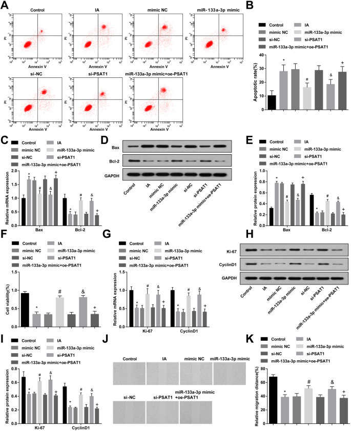 Restoring miR‑133a‑3p or Reducing PSAT1 Limits Endothelial Damage‑Driven Intracranial Aneurysm by Inhibiting the GSK3β/β‑Catenin Pathway