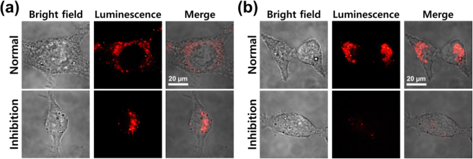 Optimizing Fe3O4‑Au Core‑Shell Nanoparticle Uptake for Targeted Endocytosis in Colorectal Cancer Cells