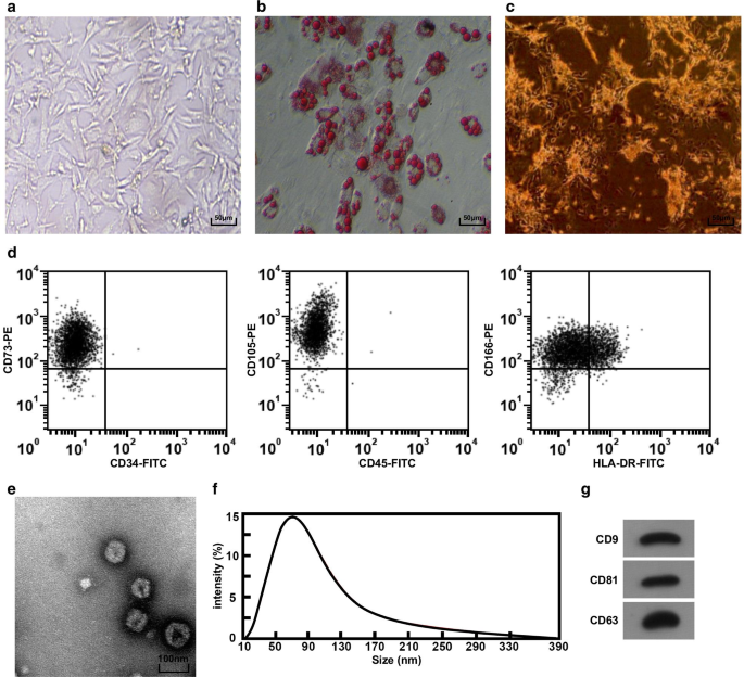 Exosomal miR‑18b‑3p from Human Umbilical Cord MSCs Lowers Preeclampsia Risk by Targeting Leptin