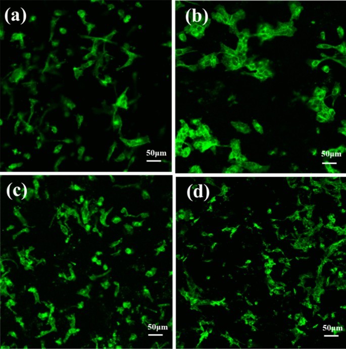 Enhancing Biocompatibility of Polyaniline/Polylactic Acid Nanofiber Scaffolds through Controlled Surface Morphology via Inorganic Acid Doping
