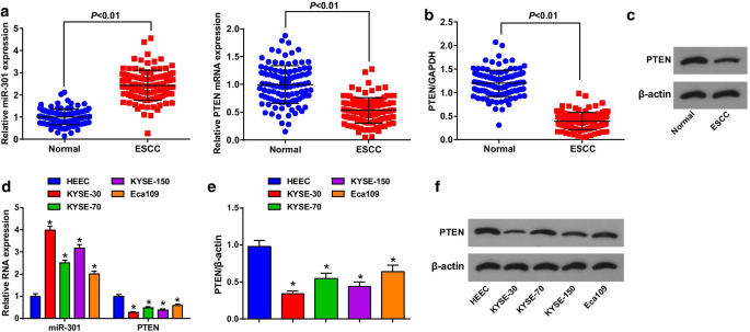 Targeting miR‑301 Suppresses Angiogenesis and Tumor Growth in Esophageal Squamous Cell Carcinoma via PTEN Activation