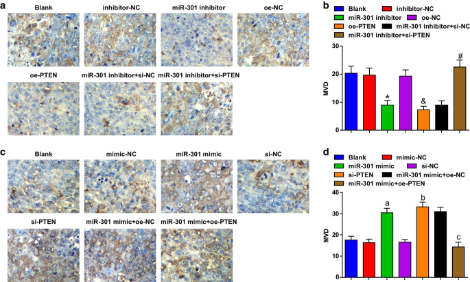 Targeting miR‑301 Suppresses Angiogenesis and Tumor Growth in Esophageal Squamous Cell Carcinoma via PTEN Activation