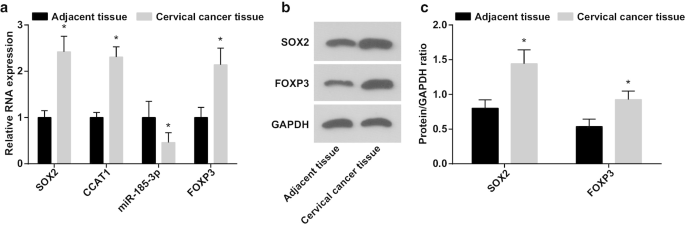 SOX2 Modulates the CCAT1/miR‑185‑3p/FOXP3 Pathway to Control Proliferation and Self‑Renewal of Cervical Cancer Stem Cells