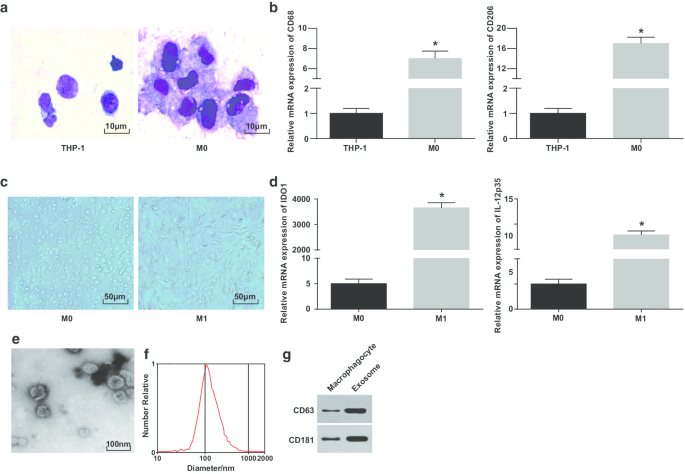 Exosomal miR‑326 from M1 Macrophages Suppresses Hepatocellular Carcinoma Progression by Modulating NF‑κB Signaling