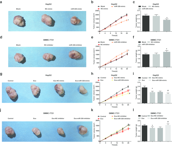Exosomal miR‑326 from M1 Macrophages Suppresses Hepatocellular Carcinoma Progression by Modulating NF‑κB Signaling