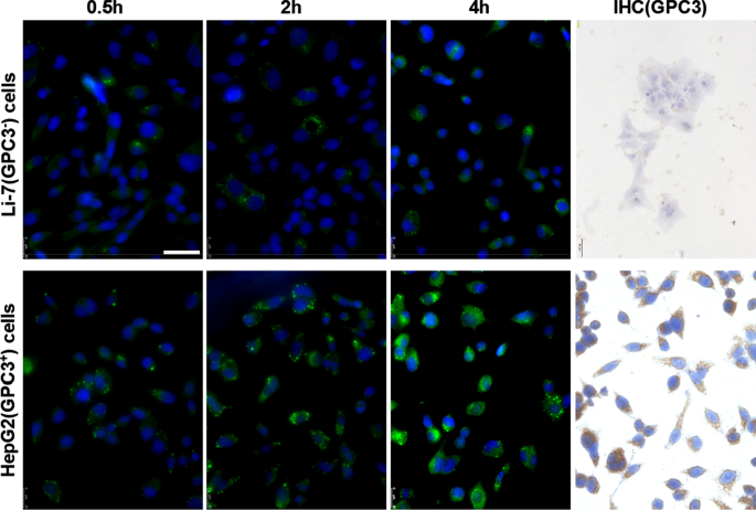 hGC33-Targeted Sorafenib Nanoparticles Synergistically Inhibit Hepatoma via Wnt Pathway Suppression