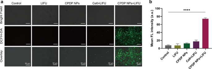 Ultrasound-Enhanced Multifunctional Nanoparticles: A Novel Platform for Imaging and Synergistic Therapy of Metastatic Breast Cancer