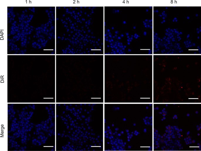 Ultrasound-Enhanced Multifunctional Nanoparticles: A Novel Platform for Imaging and Synergistic Therapy of Metastatic Breast Cancer