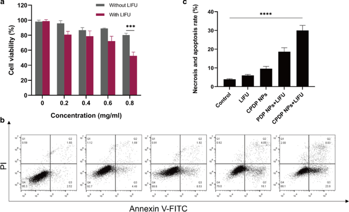 Ultrasound-Enhanced Multifunctional Nanoparticles: A Novel Platform for Imaging and Synergistic Therapy of Metastatic Breast Cancer