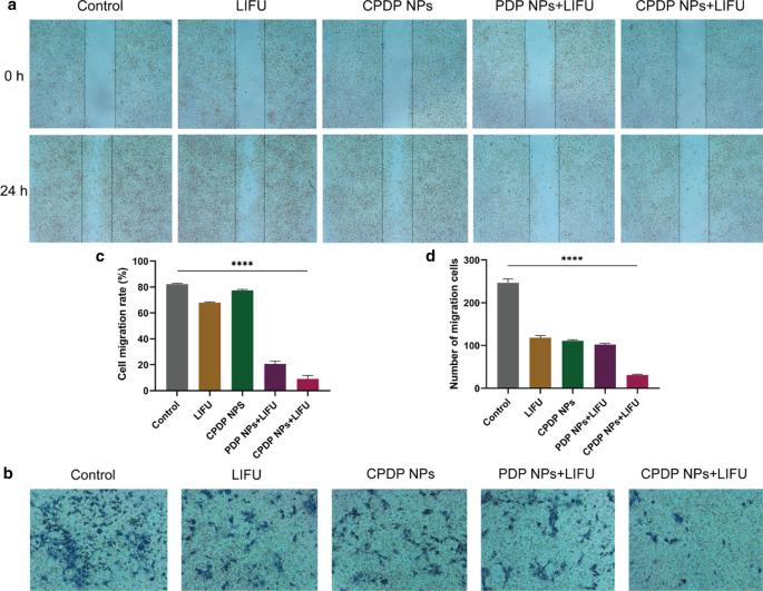 Ultrasound-Enhanced Multifunctional Nanoparticles: A Novel Platform for Imaging and Synergistic Therapy of Metastatic Breast Cancer
