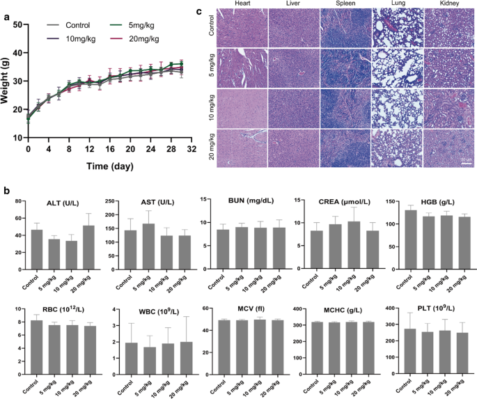 Ultrasound-Enhanced Multifunctional Nanoparticles: A Novel Platform for Imaging and Synergistic Therapy of Metastatic Breast Cancer