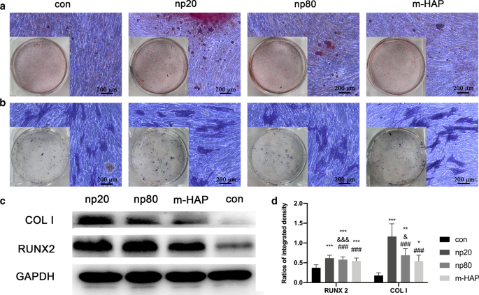 Hydroxyapatite Nanoparticles Enhance MSC Osteogenesis via Endothelial Cell Interaction