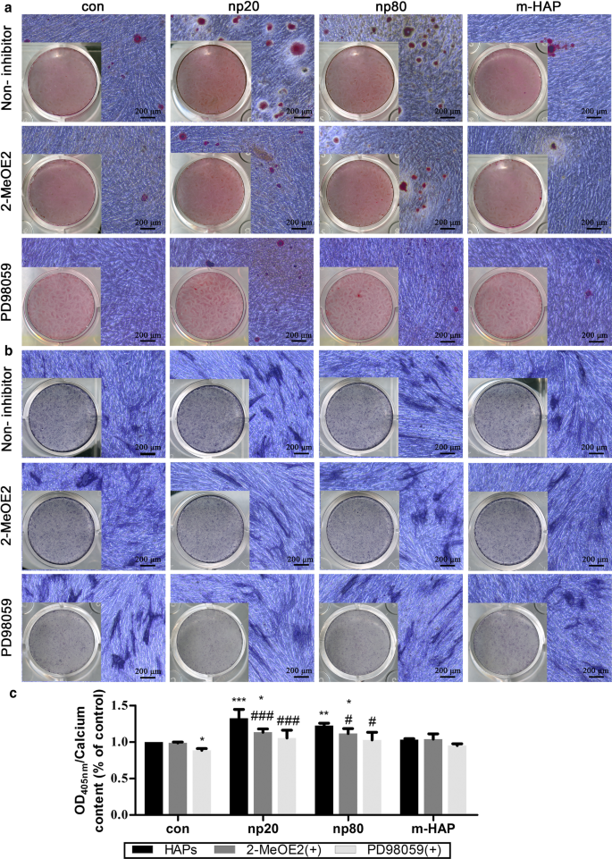 Hydroxyapatite Nanoparticles Enhance MSC Osteogenesis via Endothelial Cell Interaction