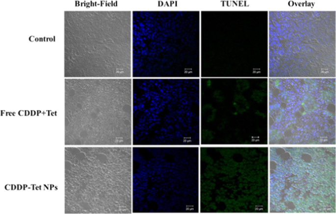 Enhanced Antitumor Efficacy of Cisplatin–Tetradrine Therapy via Biocompatible Nanoparticle Delivery