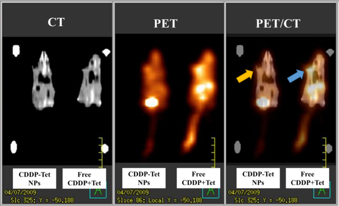 Enhanced Antitumor Efficacy of Cisplatin–Tetradrine Therapy via Biocompatible Nanoparticle Delivery