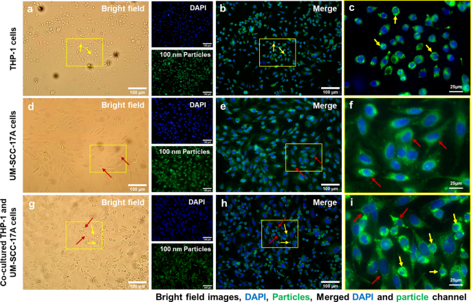 Quantitative Study of PLGA Nanoparticle Uptake in Laryngeal Cancer and Immune Cells to Improve Drug Delivery