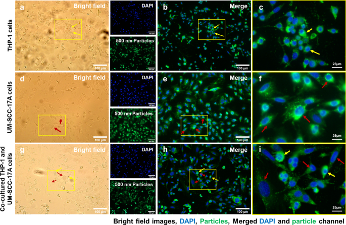 Quantitative Study of PLGA Nanoparticle Uptake in Laryngeal Cancer and Immune Cells to Improve Drug Delivery