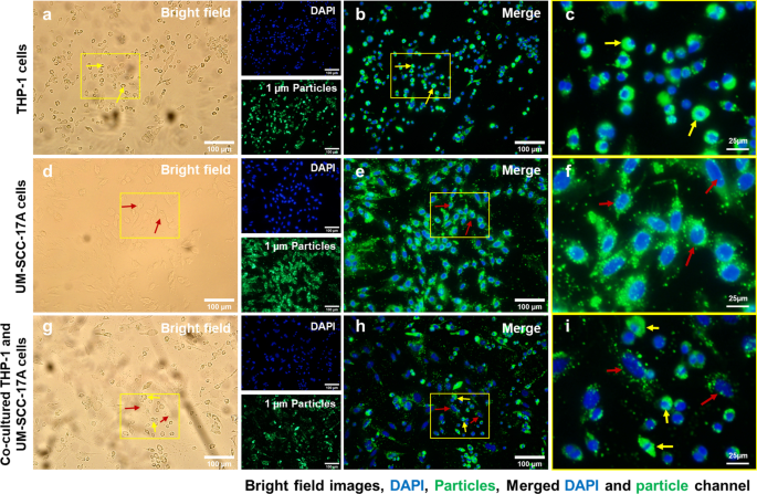 Quantitative Study of PLGA Nanoparticle Uptake in Laryngeal Cancer and Immune Cells to Improve Drug Delivery