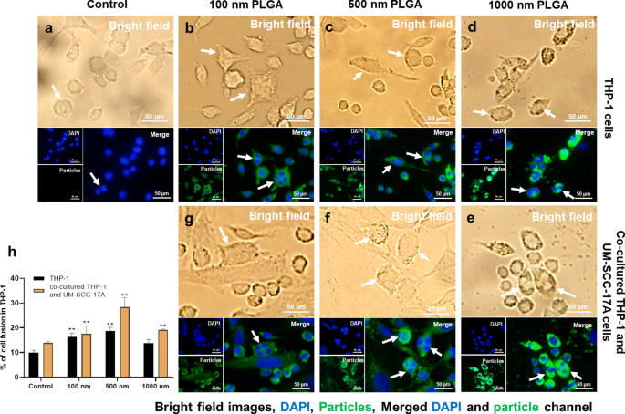 Quantitative Study of PLGA Nanoparticle Uptake in Laryngeal Cancer and Immune Cells to Improve Drug Delivery
