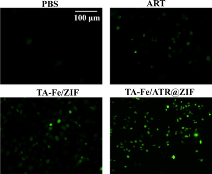 Targeted Delivery of Artemisinin via Fe(II)-Tannic Acid-Cloaked MOF Enhances Ferroptosis in Triple-Negative Breast Cancer
