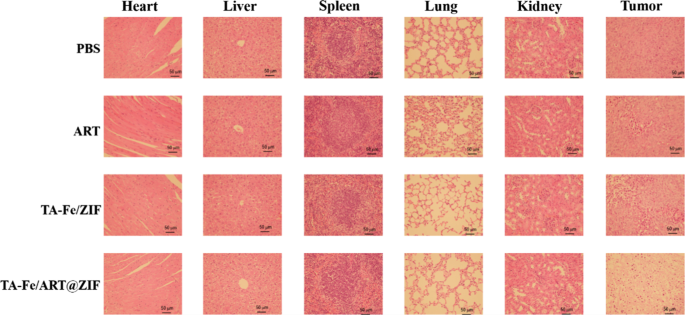 Targeted Delivery of Artemisinin via Fe(II)-Tannic Acid-Cloaked MOF Enhances Ferroptosis in Triple-Negative Breast Cancer
