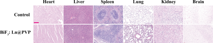 Rapid Synthesis of BiF3@Ln (Gd, Yb, Er) PVP-Coated Nanoparticles for Advanced, Low‑Toxicity CT Imaging