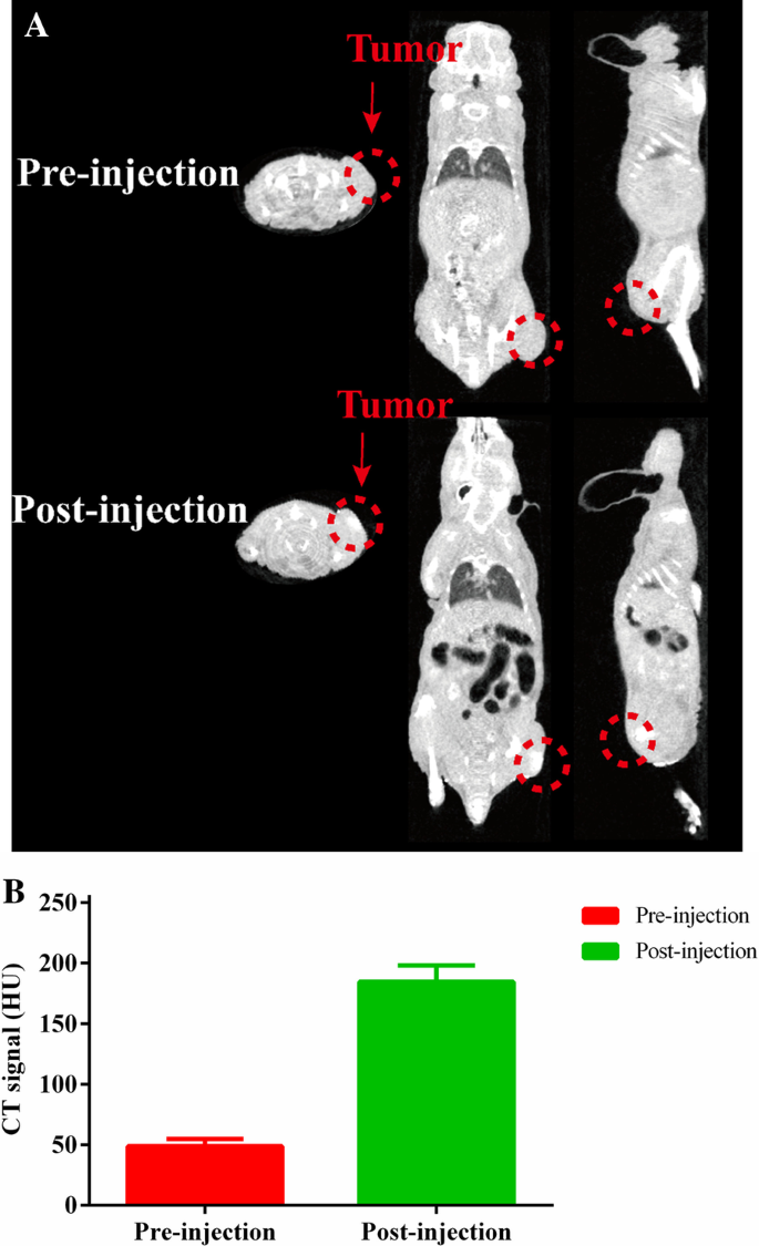 Rapid Synthesis of BiF3@Ln (Gd, Yb, Er) PVP-Coated Nanoparticles for Advanced, Low‑Toxicity CT Imaging