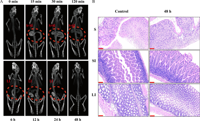 Rapid Synthesis of BiF3@Ln (Gd, Yb, Er) PVP-Coated Nanoparticles for Advanced, Low‑Toxicity CT Imaging