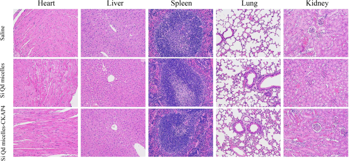 CKAP4-Linked Silicon Quantum Dot Micelles: A Novel Targeted Imaging Agent for Lung Cancer