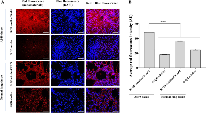 CKAP4-Linked Silicon Quantum Dot Micelles: A Novel Targeted Imaging Agent for Lung Cancer