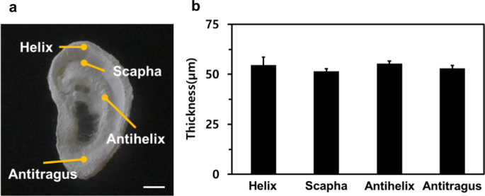 Hydrogel-Assisted Electrospinning for Conformal Nanofiber Coating on 3D Ear Cartilage Hydrogel Collectors