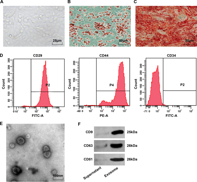 Exosomal miR-133a from Bone Marrow Stem Cells Mitigates Fibrosis & EMT in Viral Myocarditis via MAML1 Suppression