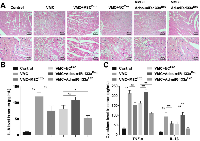 Exosomal miR-133a from Bone Marrow Stem Cells Mitigates Fibrosis & EMT in Viral Myocarditis via MAML1 Suppression