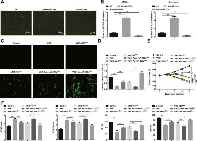 Exosomal miR-133a from Bone Marrow Stem Cells Mitigates Fibrosis & EMT in Viral Myocarditis via MAML1 Suppression