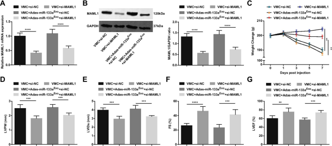 Exosomal miR-133a from Bone Marrow Stem Cells Mitigates Fibrosis & EMT in Viral Myocarditis via MAML1 Suppression
