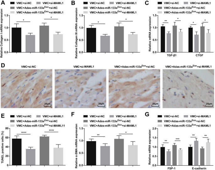 Exosomal miR-133a from Bone Marrow Stem Cells Mitigates Fibrosis & EMT in Viral Myocarditis via MAML1 Suppression