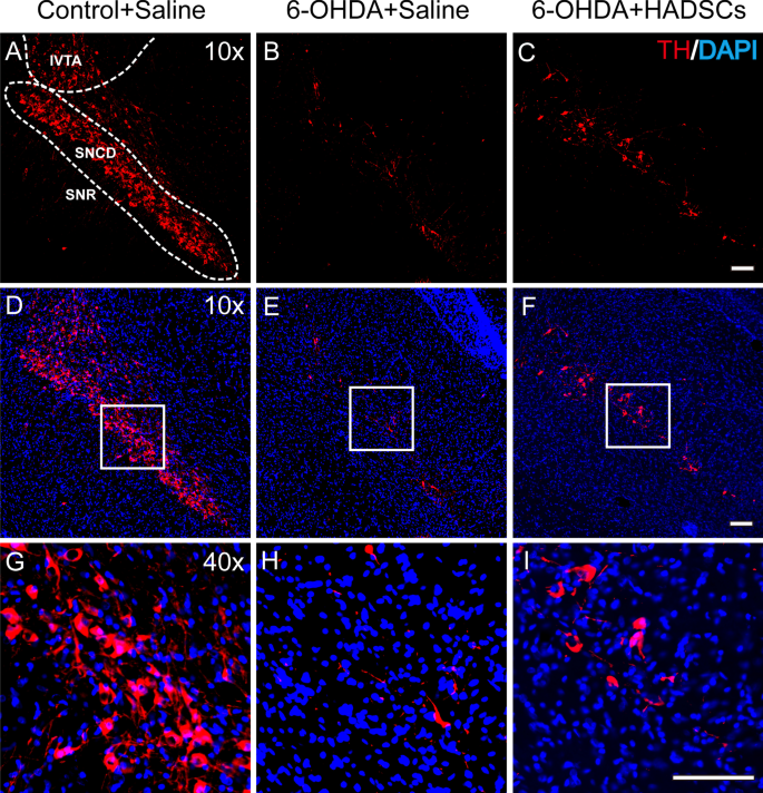 Ultrasmall Superparamagnetic Iron Oxide Nanoparticles for Stem Cell Tracking in Parkinson’s Therapy
