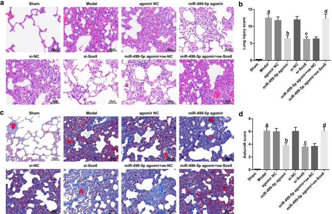 MicroRNA‑499‑5p Restores Lung Function in Sepsis‑Induced Injury by Targeting Sox6