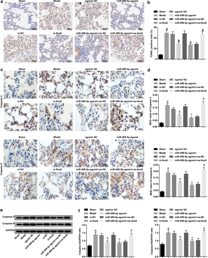 MicroRNA‑499‑5p Restores Lung Function in Sepsis‑Induced Injury by Targeting Sox6