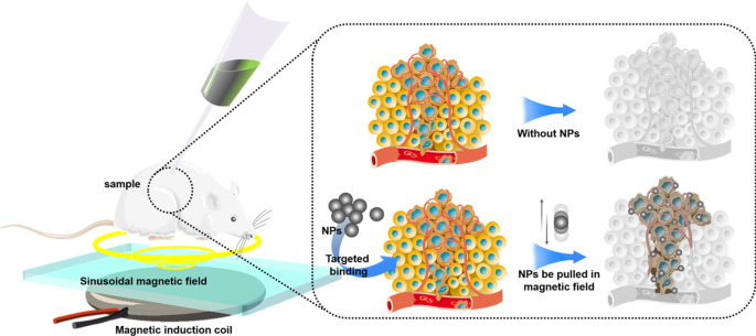 Nanoparticles: Transforming Cancer Diagnosis and Treatment with Precision