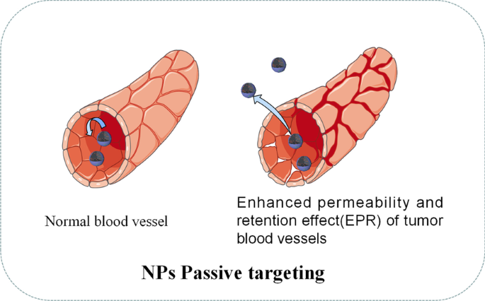 Nanoparticles: Transforming Cancer Diagnosis and Treatment with Precision