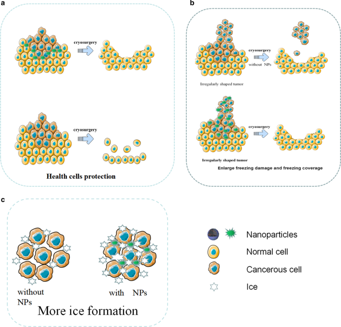 Nanoparticles: Transforming Cancer Diagnosis and Treatment with Precision