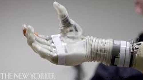 How Robot Arms Enhance Human Capabilities and Business Efficiency