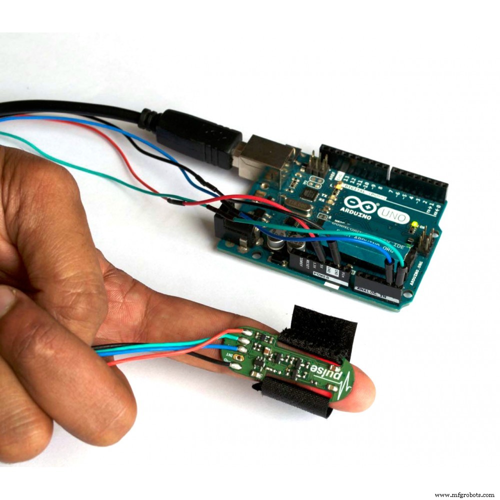 Real‑Time IoT Heart Rate Monitor with Arduino & MAX30100